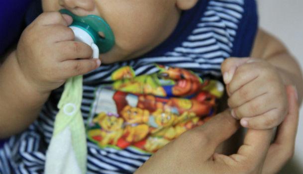 Em Pernambuco,  68 bebês tem perímetro cefálico dentro da normalidade, mas possuem alterações sugestivas de infecção nos exames de imagem e/ou nos testes laboratoriais (Foto: Ashlley Melo/JC Imagem)