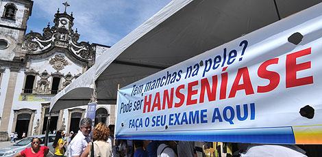 Segundo país do mundo em casos de hanseníase, Brasil também precisa combater o preconceito