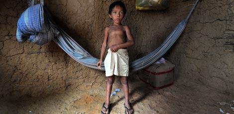 Pelo menos cinco crianças morrem de fome a cada minuto, diz ONG