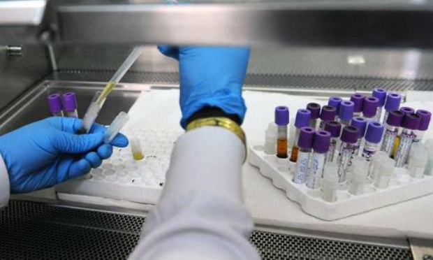 Fênomeno natural de integração do HIV no DNA abre novas perspectivas no estudo da doença