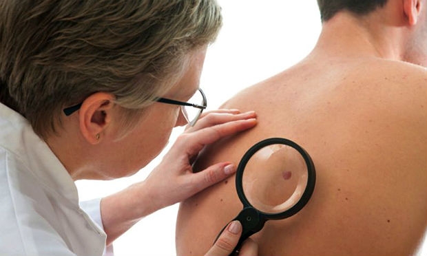 Cerca de 182 mil pessoas apresentarão câncer de pele em 2014, alerta o Inca / Foto: divulgação