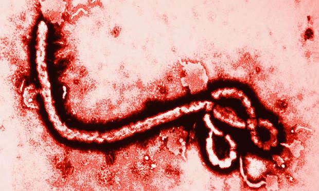 Tratamento francês contra ebola revela resultados positivos