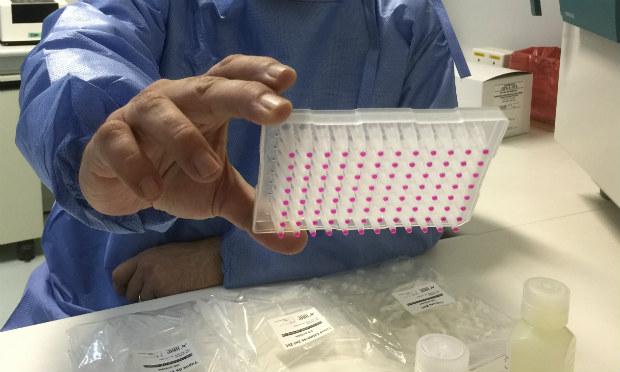 Teste rápido da Unicamp detecta zika em 5 horas