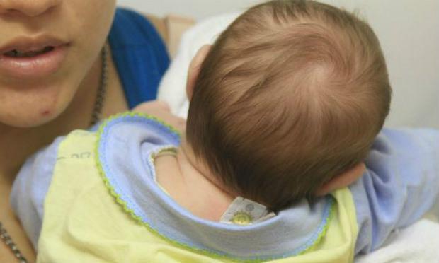 Após nascimento, bebês com zika desenvolvem microcefalia, diz estudo