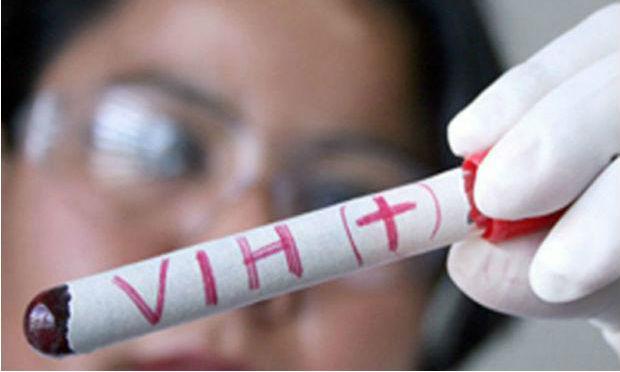 Teste de nova vacina experimental contra a aids renova esperança