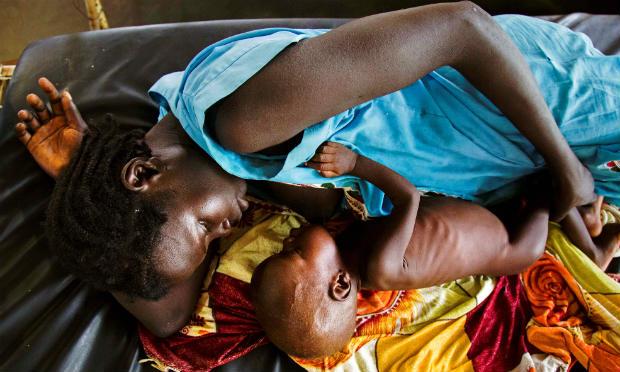 No Sudão do Sul, mais de 270 mil crianças estão desnutridas / Foto: AFP