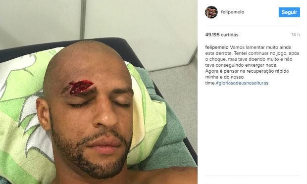 Felipe Melo sofreu um corte profundo numa cabeçada com o companheiro de defesa Mina. / Foto: Reprodução/Instagram.